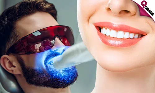 Zoom Teeth Whitening + Dental Consultation!